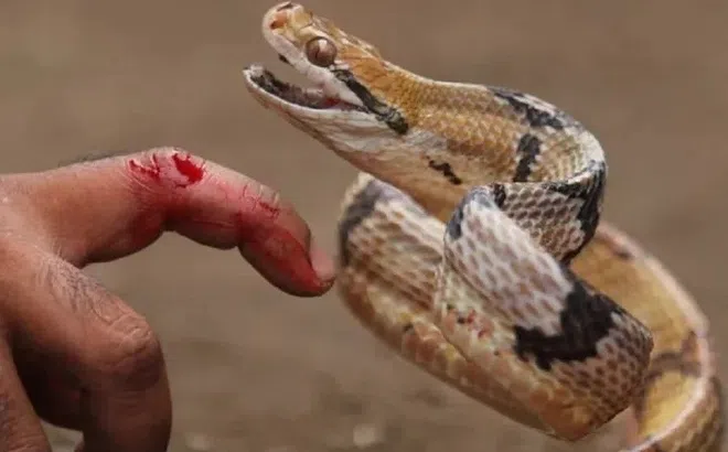 Cứu sống ngoạn mục bệnh nhân bị rắn hổ mang cắn trong tình trạng nguy kịch