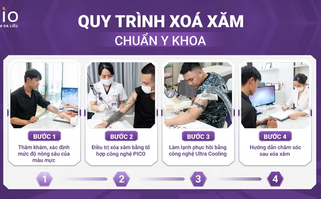 Tiết kiệm thời gian với phác đồ Xóa xăm Pico 3X tại Phòng khám OHIO