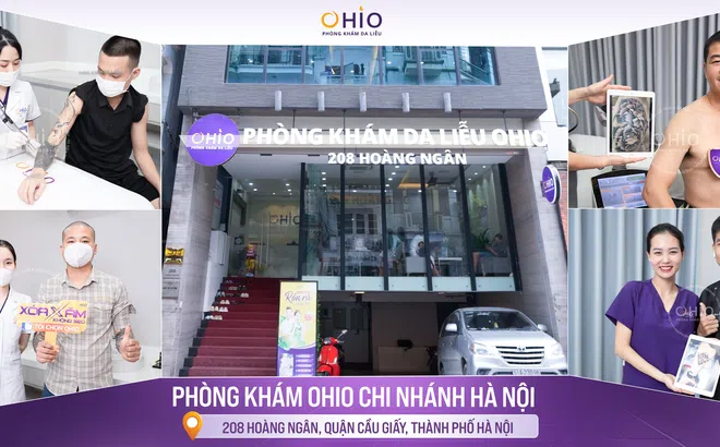 Top 1 địa chỉ Xóa xăm uy tín tại Hà Nội