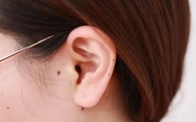 Cơ thể có 5 dấu hiệu này chớ coi thường, 'sát thủ thầm lặng' đang gõ cửa, nhiều người bỏ qua dấu hiệu thứ 3