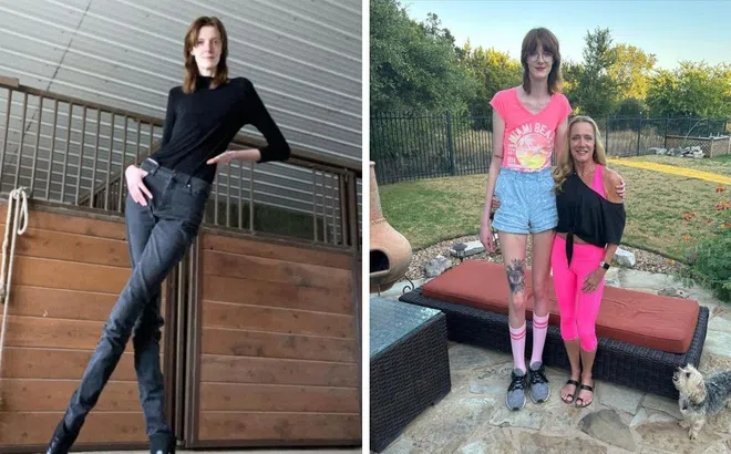 Cô gái có đôi chân dài nhất thế giới tiết lộ bí mật khi hẹn hò, mua sắm