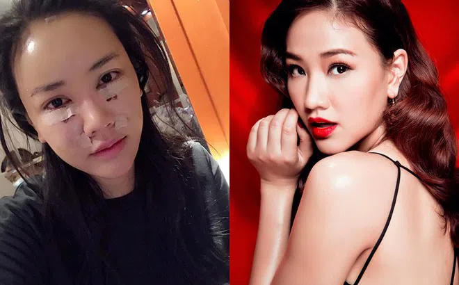 Sau ca phẫu thuật 600 triệu đồng, Maya trẻ trung như gái đôi mươi