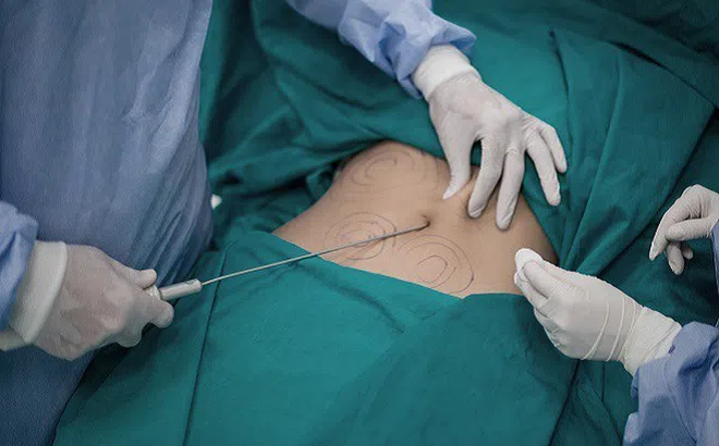 Ám ảnh những sự cố thương tâm vì phẫu thuật thẩm mỹ