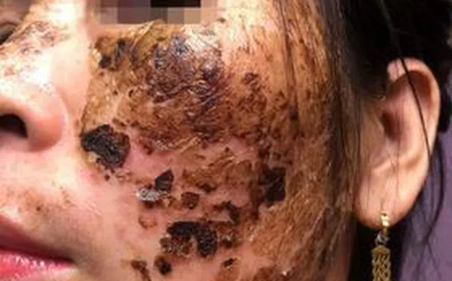 Khách hàng bị “nát mặt” vì… dự hội thảo làm đẹp!